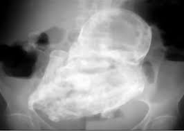 ����� �������� �� ��������� �������, �������� ����� 40 ��� �����